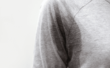 Sweating it Out: Life with Hyperhidrosis