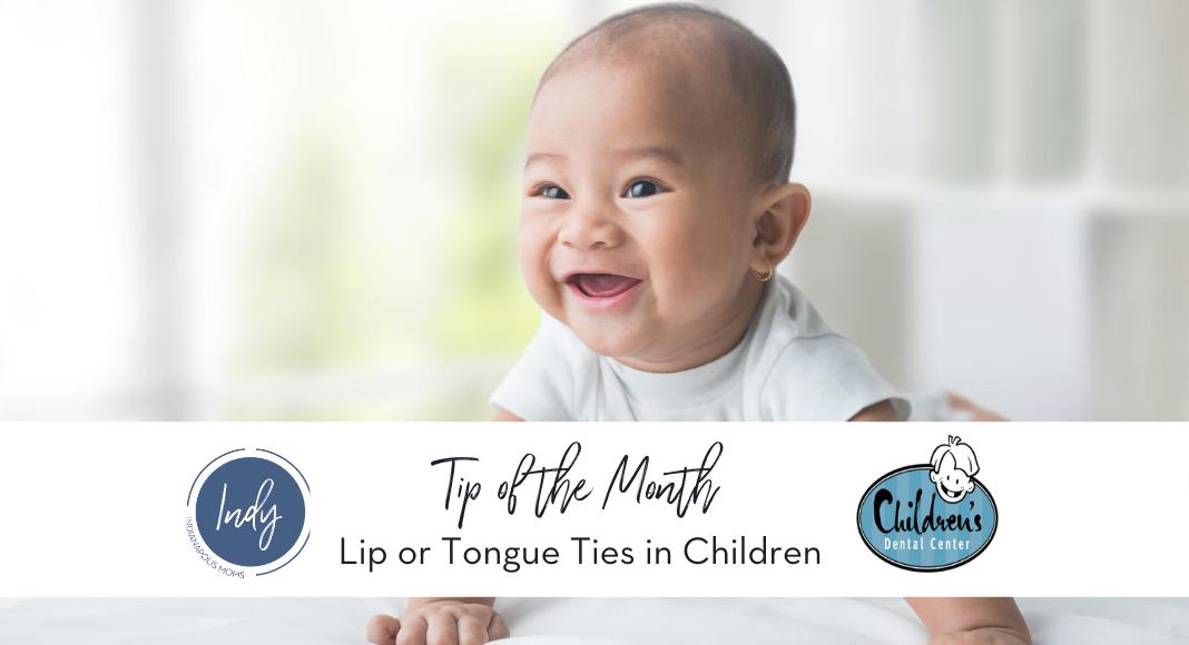 lip and tongue ties