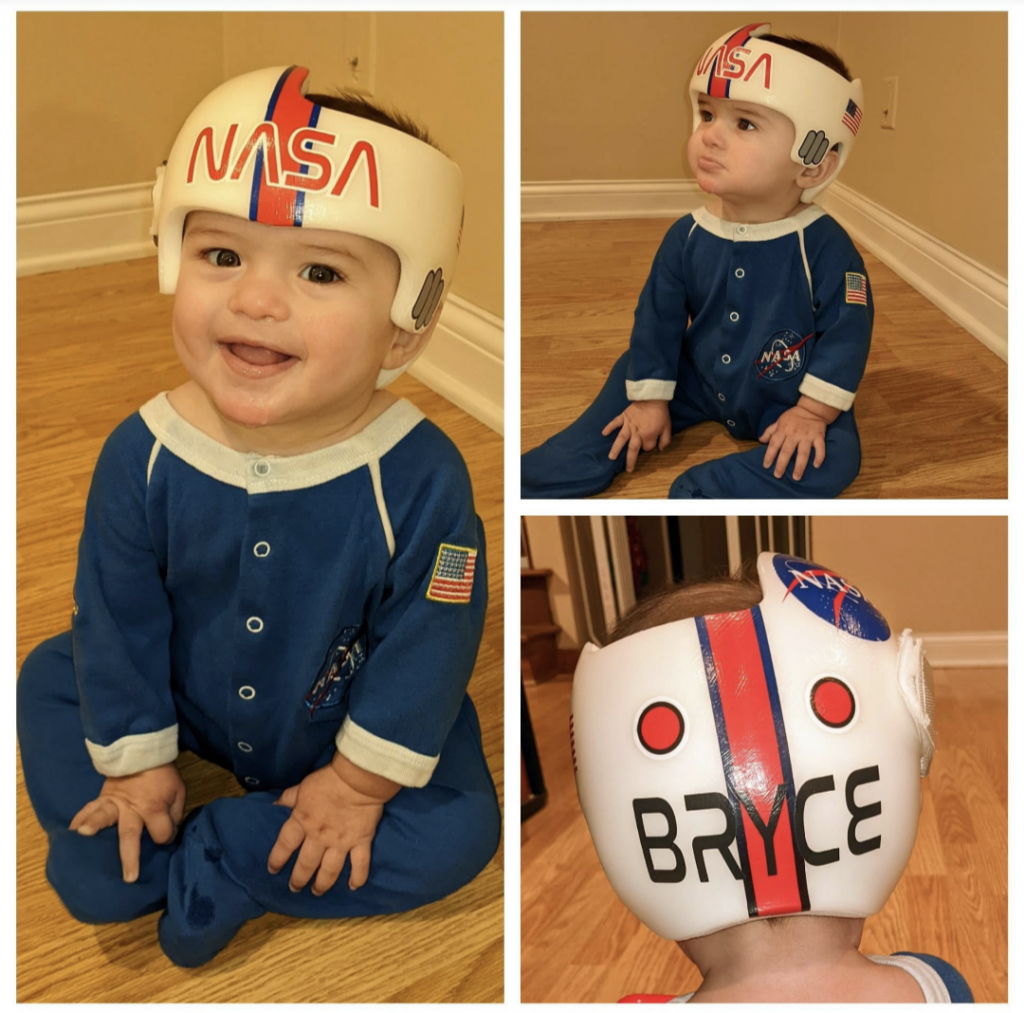 Your Baby Needs a Helmet Plagiocephaly and Torticollis Awareness