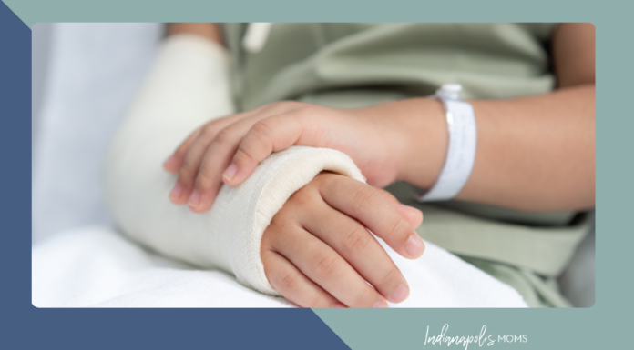 Broken Bone, Not Broken Fun: 8 Cast-Friendly Things to Do Around Indianapolis
